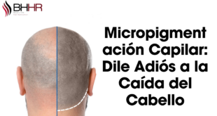 micropigmentacion de cabello